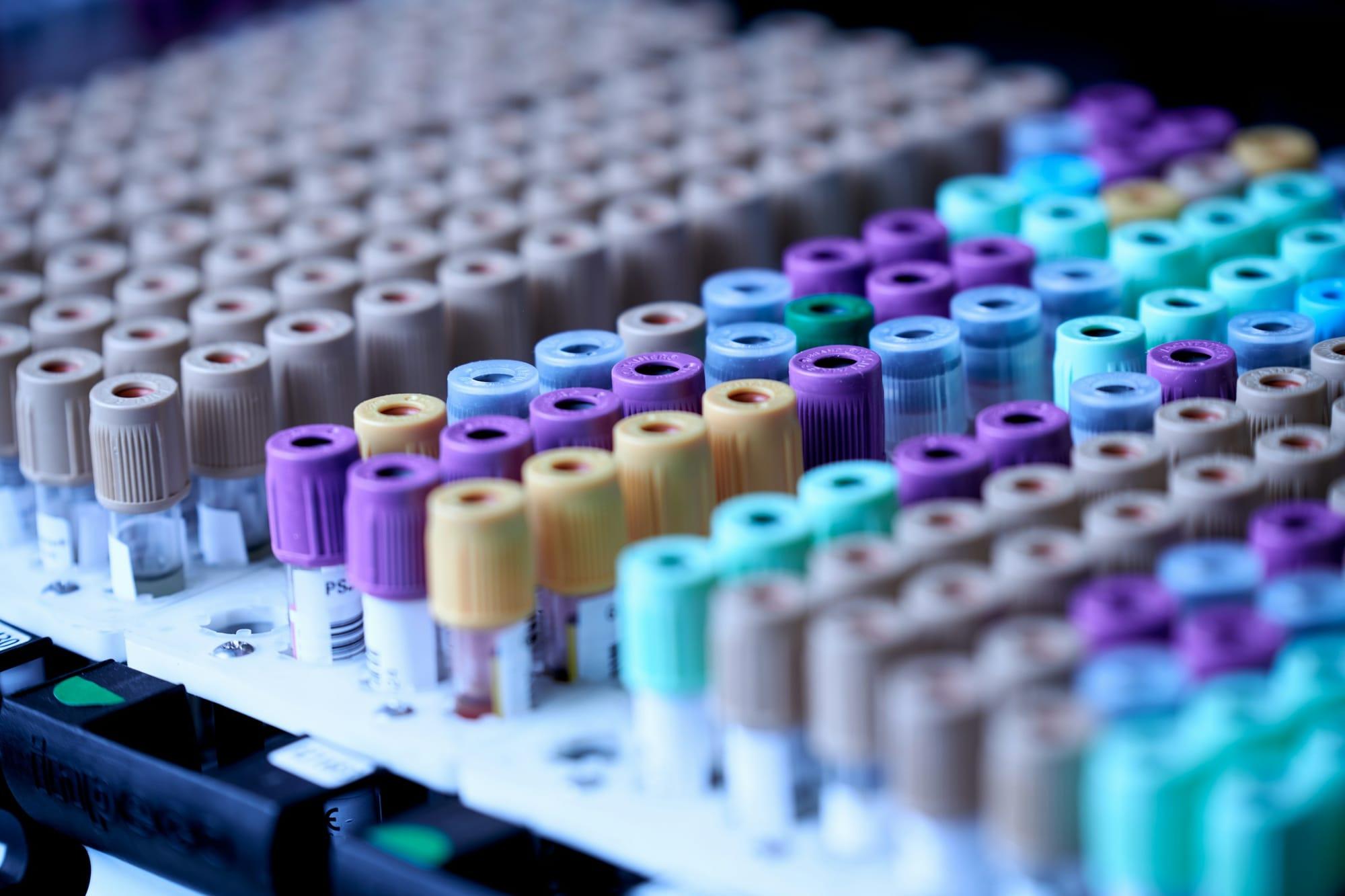 Rows of blood collection tubes with coloured caps in a laboratory rack